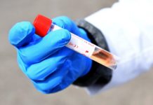 São Paulo e Rio de Janeiro registram caso suspeito de ebola