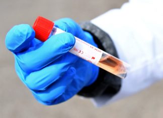 São Paulo e Rio de Janeiro registram caso suspeito de ebola