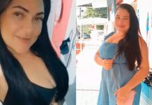 Fortaleza – Mulher agredida pelo ex com martelo sofreu fratura no maxilar e perdeu os dentes: ‘Passei 13 dias intubaba’