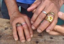 Poranga CE – Bombeiros retiram 8 anéis presos em dedos de homem