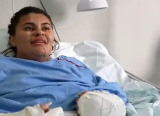 Ana Clara fala pela primeira vez sobre ataque que decepou suas mãos: ‘Sou um testemunho’