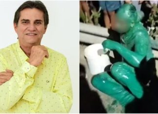Morre vereador que causou acidente de trânsito que ‘deixou homem verde’ no Ceará